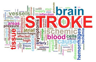Cara mengobati stroke mata, Tanaman Obat Tradisional Untuk Stroke, Obat Stroke Lidah Kaku, Obat Stroke Yang Mujarab, Obat Stroke Terbaik, Ramuan Untuk Mengobati Penyakit Stroke, Cara Mengobati Stroke Susah Bicara, Komplikasi Penyakit Stroke Hemoragik, Obat Stroke Pecah Pembuluh Darah, Penyakit Stroke Mati Sebelah, Penyakit Stroke Dan Cara Pencegahannya